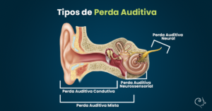 Tipos de Perda Auditiva - Novo